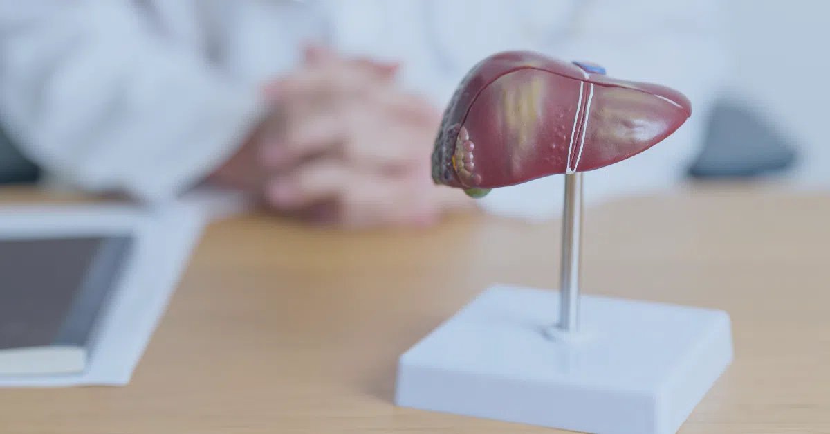 METABOLIC DYSFUNCTION-ASSOCIATED STEATOTIC LIVER DISEASE (MASLD)