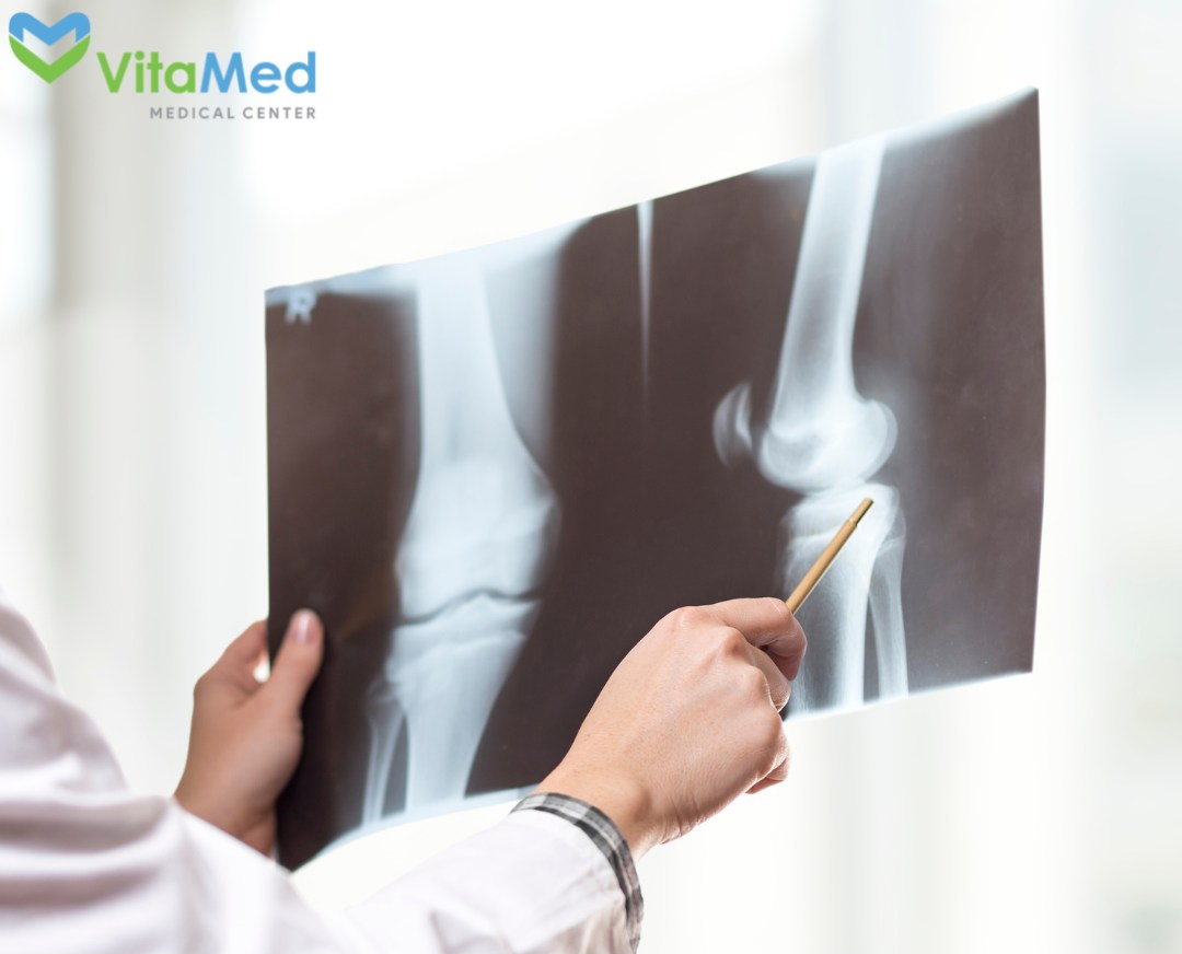 РЕНТГЕН В ЕРЕВАНЕ, АРМЕНИЯ