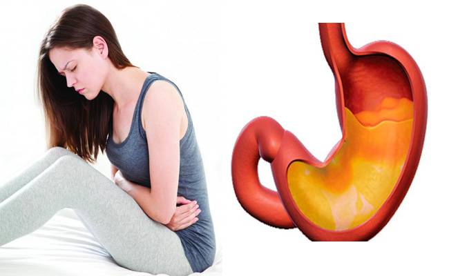 DYSPEPSIA: DIAGNOSIS AND TREATMENT