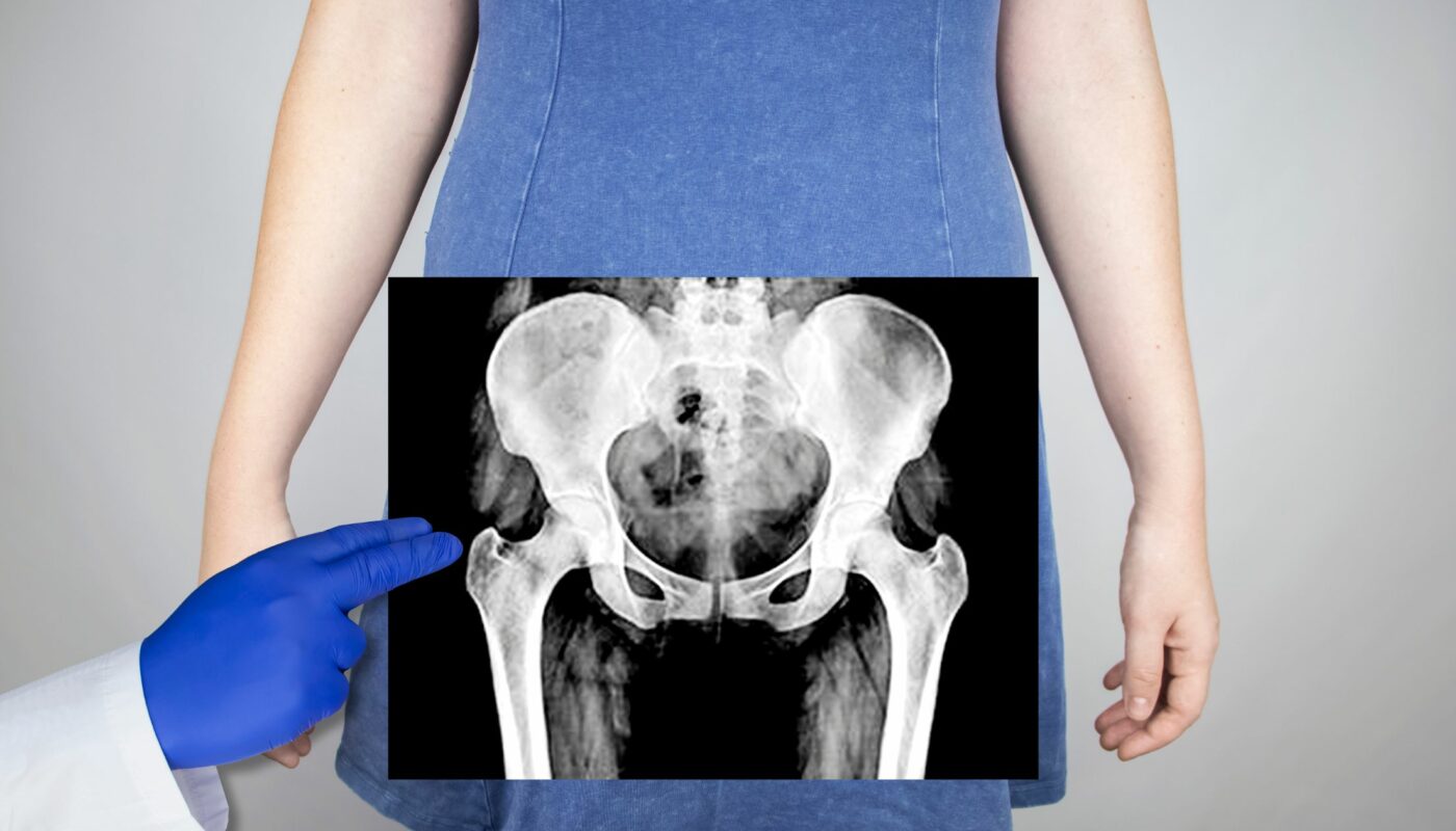 HIP JOINT X-RAY IN ARMENIA