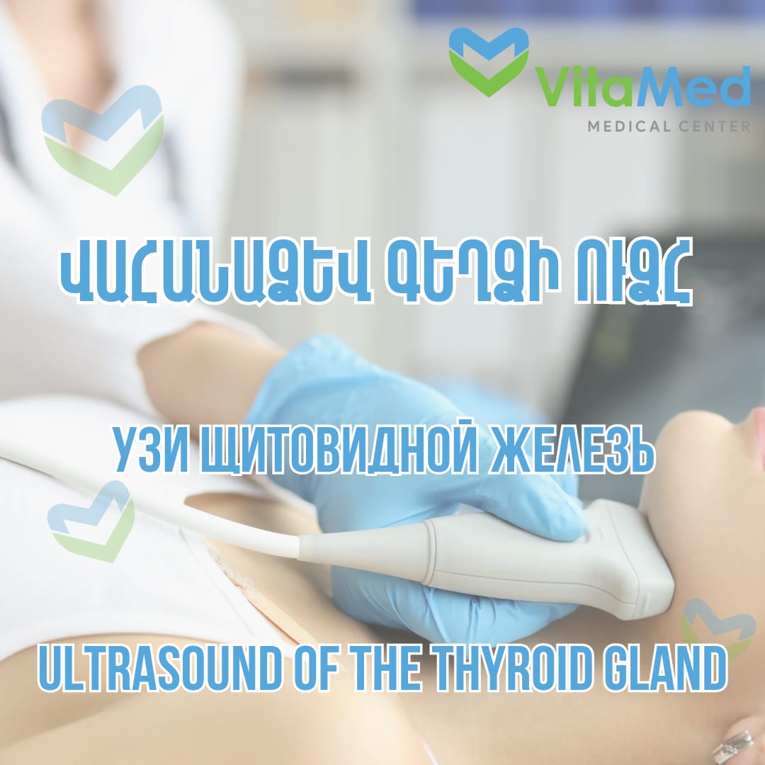 ՎԱՀԱՆԱՁԵՎ ԳԵՂՁԻ ՍՈՆՈԳՐԱՖԻԱ (ՈՒՁՀ)