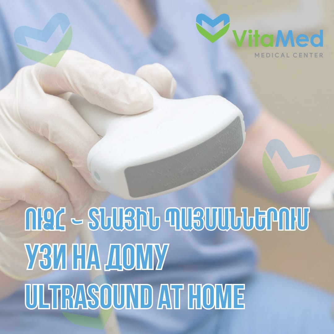  СОНОГРАФИЯ (УЗИ) ДОМА, НА ДОМУ В ЕРЕВАНЕ