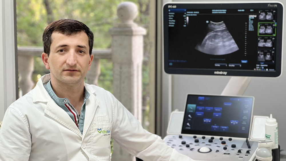 ДУПЛЕКС В ДОМАШНИХ УСЛОВИЯХ В ЕРЕВАНЕ