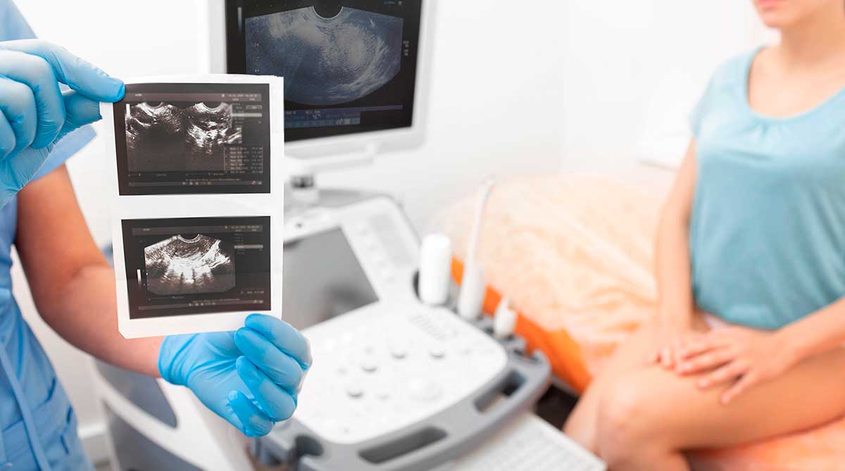 ТРАНСВАГИНАЛЬНОЕ УЗИ