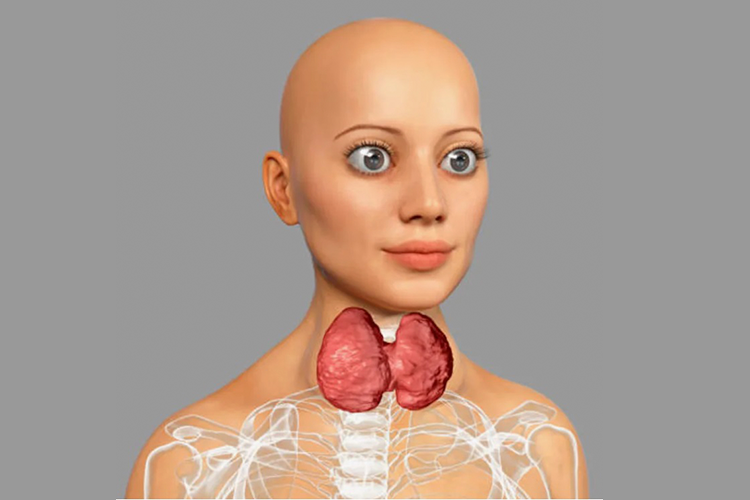 ДИФФУЗНЫЙ ТОКСИЧЕСКИЙ ЗОБ