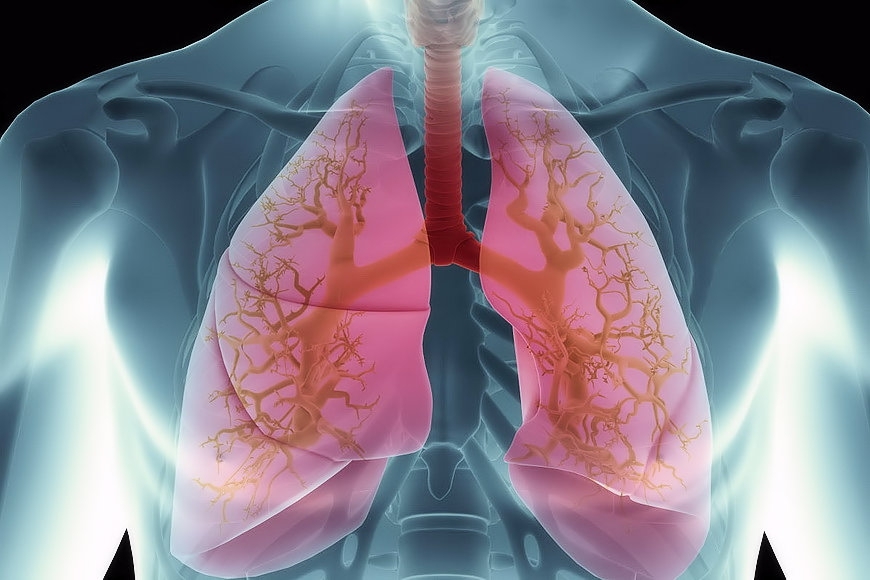 ULTRASOUND OF THE LUNGS AND PLEURAL SINUSES